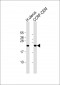 KLRC2 Antibody (N-term)